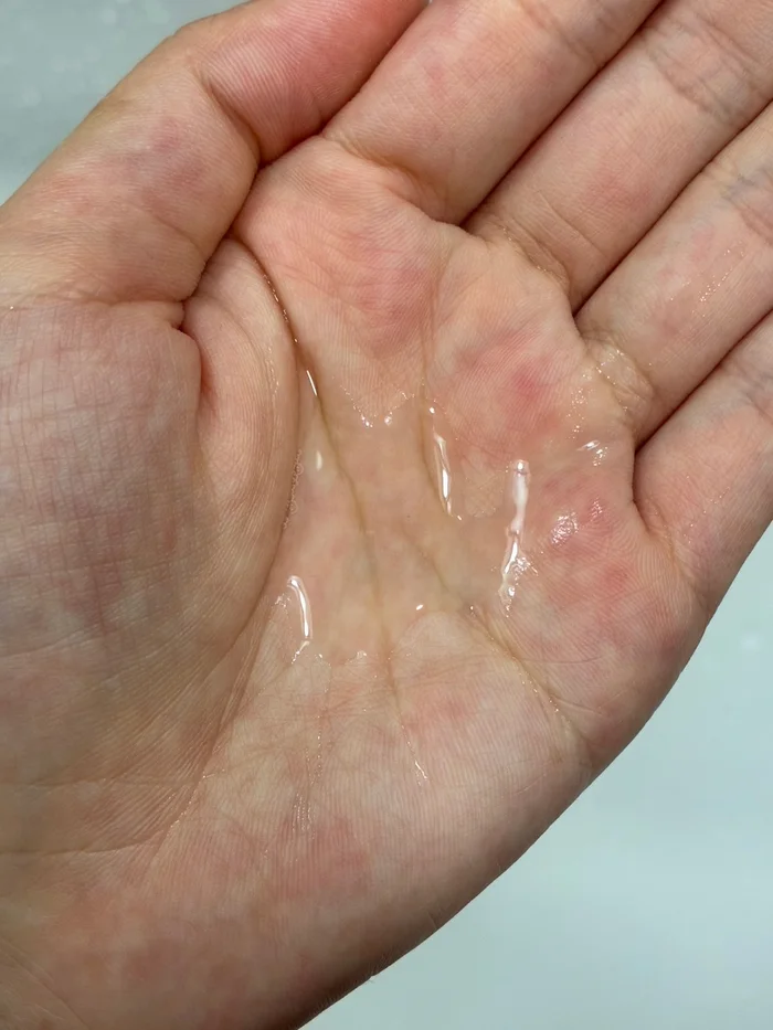 画像 手のひらに出したチャコット クレンジングウォーターの液